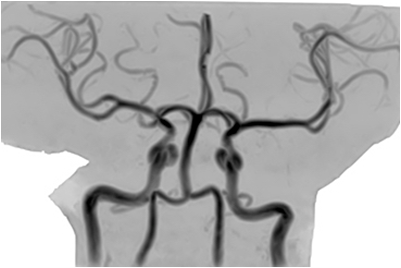 image A