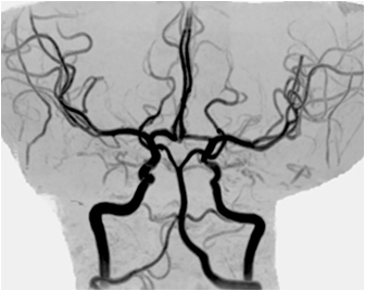 image B