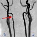 Case3 整体で頭痛が悪化